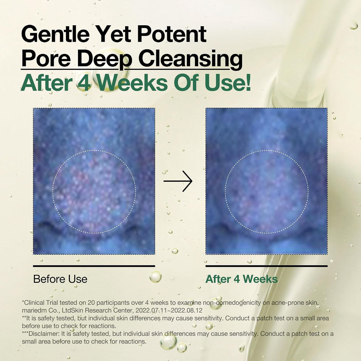 ANUA Heartleaf cleansing brand study illustration and study notes