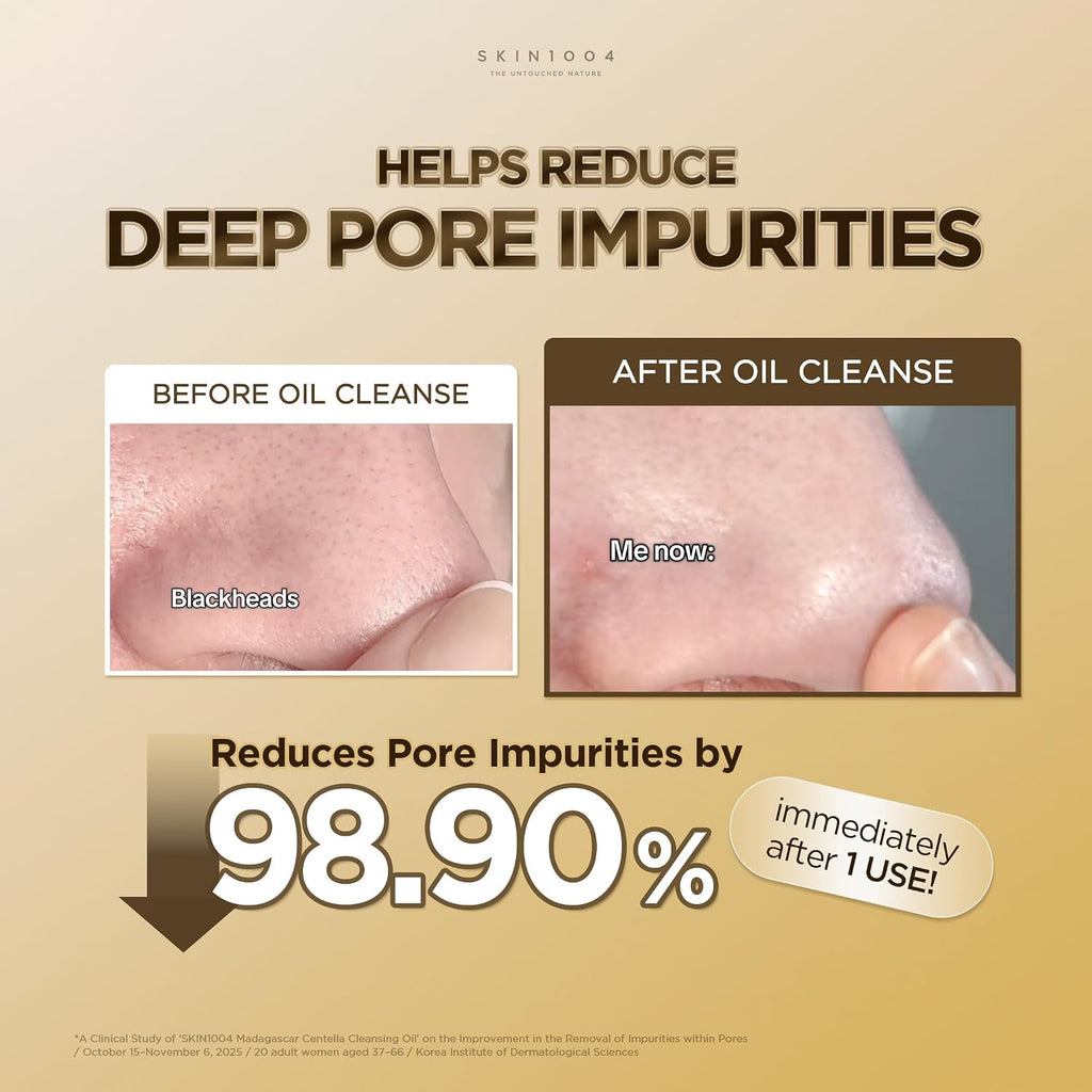 SKIN1004 Light Cleansing Oil brand pore impurity study details